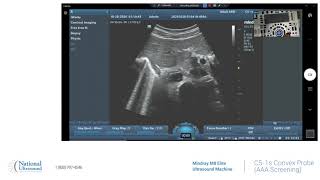 M8 Elite AAA Abdominal Aortic Aneurysm Screening Training Video [upl. by Hannahc]