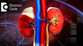 What is Prerenal amp Postrenal Acute Kidney Injury What is Uremic Syndrome  Dr Manoharan B [upl. by Aiyn]