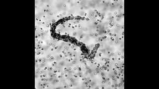 Human Eosinophils Coat a Worm [upl. by Fujio]