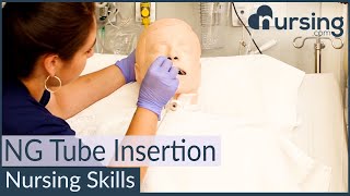 NG Nasogastric Tube Insertion Techniques Nursing Skills [upl. by Petua]