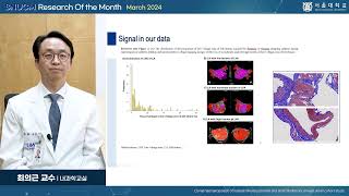 SNU MEDICINE 이달의 연구 2024년 3월 내과학교실 최의근 교수님클론성 조혈증과 심방세동동아시아 코호트 연구 [upl. by Onivag166]