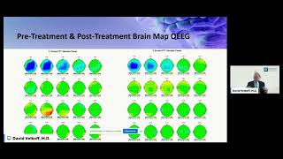 How Neurofeedback Improves Brain Functioning amp Reduces Autism Symptoms [upl. by Takakura]