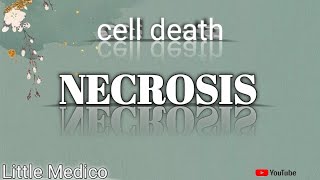 Necrosis and types of necrosis pathology robbins [upl. by Lorsung343]