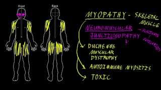 Myopathy and neuromuscular junctionopathy [upl. by Homans175]