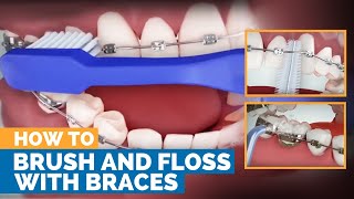 How to Brush amp Floss with Braces [upl. by Marvella]