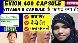 vitamin e capsules evion 400 capsules for face pigmentation pimples ko kese thik karta hai [upl. by Ahsuoj8]