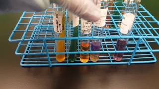 Microbiology Escherichia coli Biochemical testing interpretation [upl. by Parshall895]