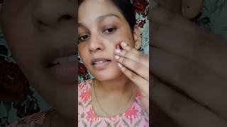 உங்க face ல இருக்கிற pigmentation Remove பண்ணனுமா  natural remedies for pigmentation [upl. by Albie]