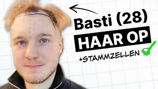 Bastis Haartransplantation mit Stammzellentherapie  Erfahrung [upl. by Bordy284]