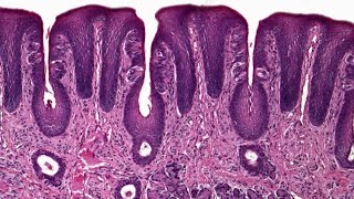 Circumvallate papillae  practical Histology [upl. by Ialohcin92]