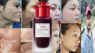 Skintific 12 AHA BHA PHA LHA Peeling Solution  Honest Review [upl. by Agemo]