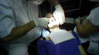 My sisters tooth extraction [upl. by Aniryt]