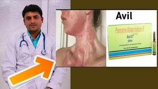 Avil injection and avil tablet use in hindi [upl. by Durno]