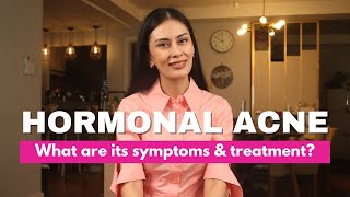 Hormonal Acne What are its Symptoms amp Treatment  Dr Gaile RobredoVitas [upl. by Nyasuh]