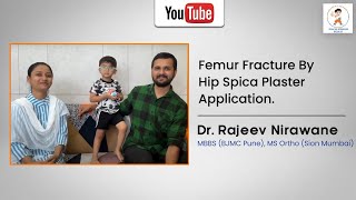 Treatment Of Femur Fracture By Hip Spica Plaster Application [upl. by Nunciata]