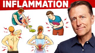 The 1 Best Remedy for Inflammation Autoimmune Gut and Arthritis That You Never Considered [upl. by Hultgren]