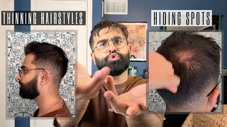 How to style SHORT THINNING Hair  Mens Hair Loss [upl. by Ashlin]