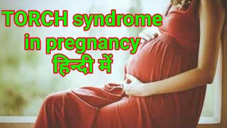 TORCH syndrome TORCH profile test in hindi [upl. by Innes134]