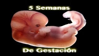 Milagro De Gestación  5 Semanas De Gestación [upl. by Haag]