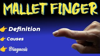 mallet finger  causes  diagnosis  treatment [upl. by Dallas864]