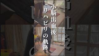 【小脳出血後リハビリの軌跡】手足の震えとバランス障害が顕著だったお客様 [upl. by Otrebtuc]