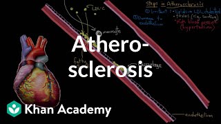 Atherosclerosis  Circulatory System and Disease  NCLEXRN  Khan Academy [upl. by Constant]