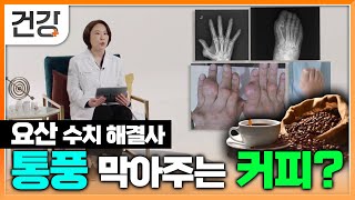 매일 마시던 커피 통풍 예방에 도움이 된다  통풍 원인 요산 수치 낮추는 방법  명의  EBS건강 [upl. by Yllor]