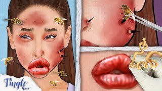 ASMR Satisfying Bee Sting Treatment For Ariana Animation  Severely Injured Animation [upl. by Dranreb]