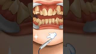 ASMR teeth cleaning animation youtubeshorts [upl. by Nyliak]