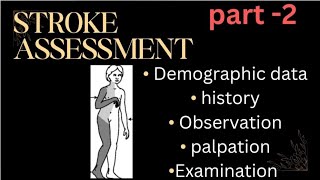 Stroke Assessment part 2 [upl. by Jeni328]