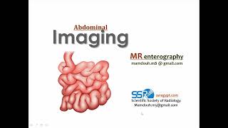 3 MR enterography technique amp clinical applications Prof Mamdouh Mahfouz [upl. by Calva874]