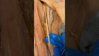 Real Femoral Artery amp Nerve [upl. by Margareta]