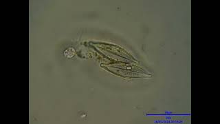 Heliozoa I think Investigates Diatoms [upl. by Eixam512]