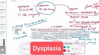 Dysplasia Pathology 4  First Aid USMLE Step 1 in UrduHindi [upl. by Gypsy]