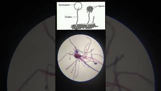 Rhizopus slide under MicroscopeMicroorganism [upl. by Ettenauq619]