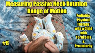 6 Measuring Passive Neck Rotation Range Pediatric PT with a Child with Torticollis amp Prematurity [upl. by Ahsiekit]