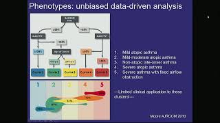 Treatment Options in Severe Eosinophilic Asthma mp4 [upl. by Ihdin]