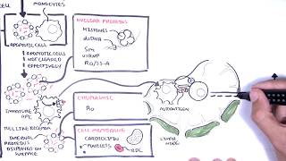 Systemic Lupus Erythematosus SLE  signs and symptoms pathophysiology investigations treatment [upl. by Coheman]