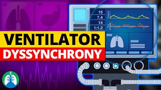 Ventilator Dyssynchrony Medical Definition  Quick Explainer Video [upl. by Oreste]