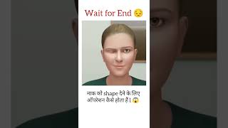 Nose operation 😱  shortsviral nose operation viral ytshort ytviral [upl. by Ellehcsar222]