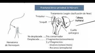 TRAUMATOLOGÍA Y ORTOPEDIA RESUMEN TIPO ENARMAMIR [upl. by Mungam417]