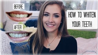 HISMILE TEETH WHITENING KIT REVIEW  Mel Joy [upl. by Fenny]