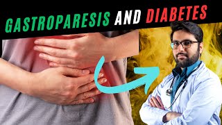 Gastroparesis and Diabetes Understanding the Connection and Implications [upl. by Annat]