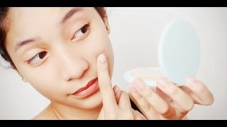 How to remove acne scars [upl. by Dorothee383]