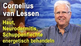 Haut Neurodermitis Schuppenflechte energetisch behandeln  Cornelius van Lessen [upl. by Imak]