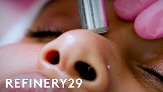 What Microdermabrasion Looks Like Up Close  Macro Beauty  Refinery29 [upl. by Oribella]