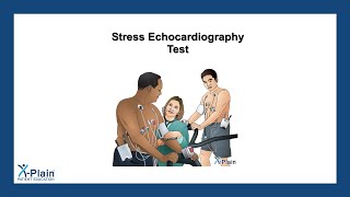 Stress Echocardiography Test [upl. by Ysiad]