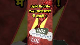 Lipid Profile Test Guide  HDL LDL Triglycerides Explained iskibhenkimajemaje shorts viralshort [upl. by Stan849]