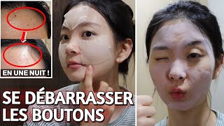 TOP 6 SOINS COSMÉTIQUES CORÉENS  │ FAIRE DISPARÎTRE LES BOUTONS EN UNE NUIT 😱 [upl. by Akemyt]