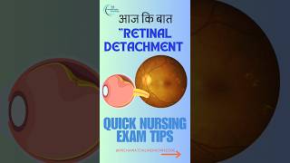 Can You Spot Retinal Detachment Symptoms FAST 👁️✨ [upl. by Anotal]